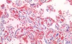 Hemoglobin A2 Antibody, Novus Biologicals 50 &mu;g | Buy Online | Novus Biologicals | Fisher Scientific